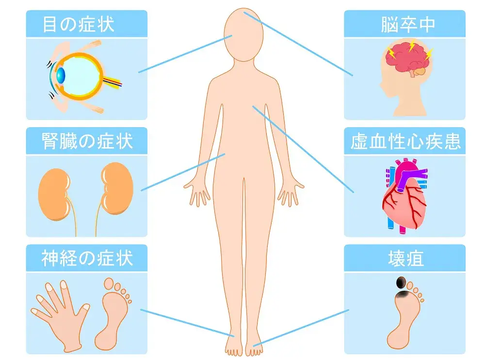 糖尿病と合併症